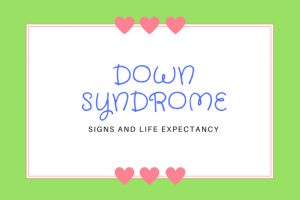 Down syndrome signs and life expectancy