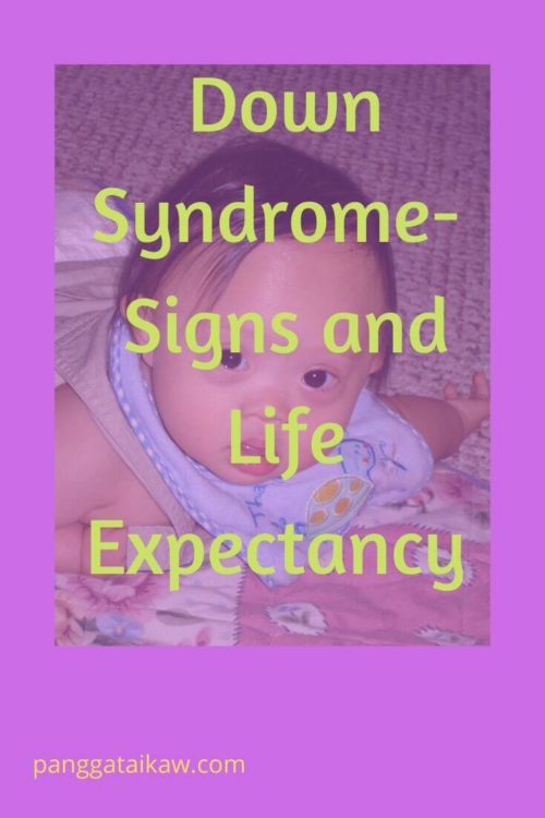 Down Syndrome-Signs and Life Expectancy