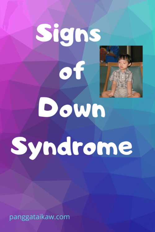 Signs of Down Syndrome and Life Expectancy | Pangga ta Ikaw