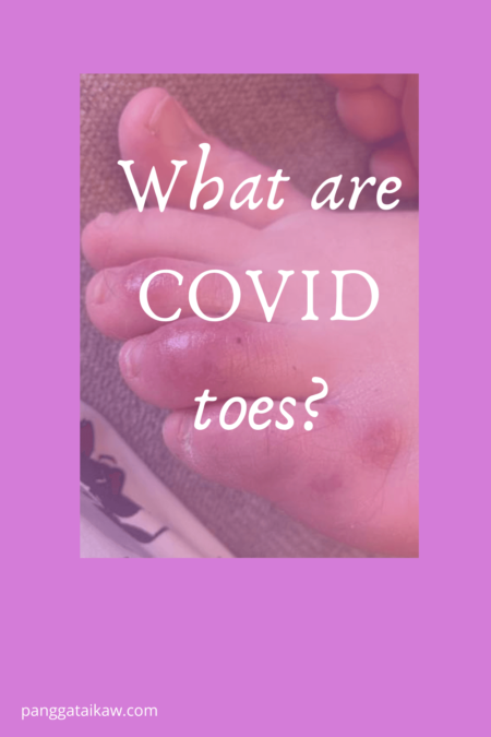 What are COVID toes?
